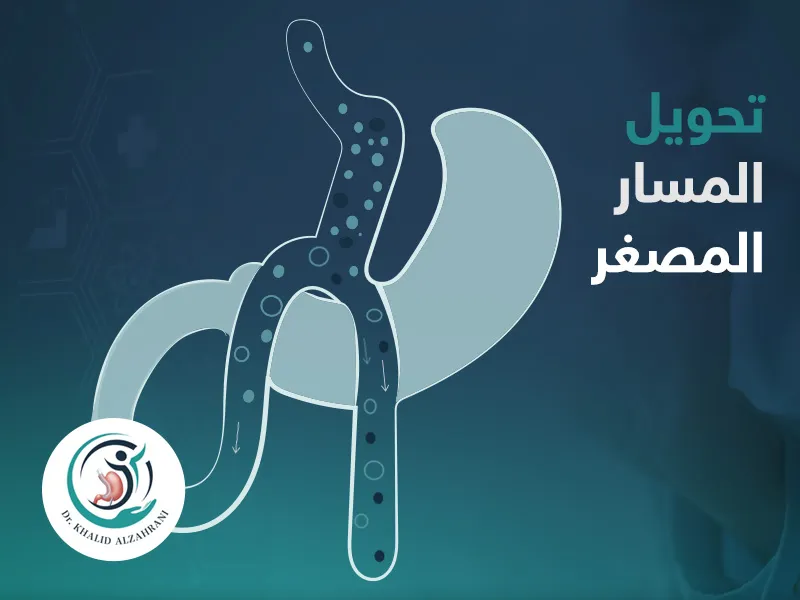 تحويل المسار المصغر