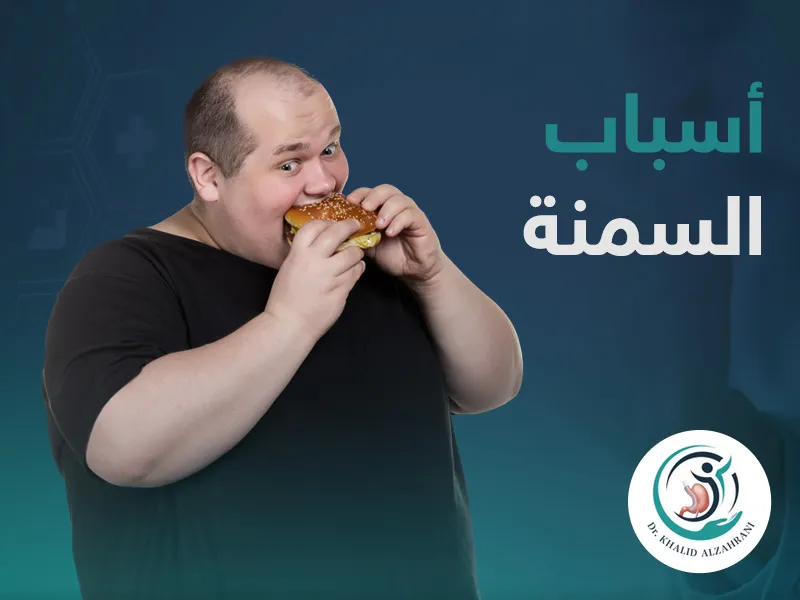 اسباب السمنة المفرطة