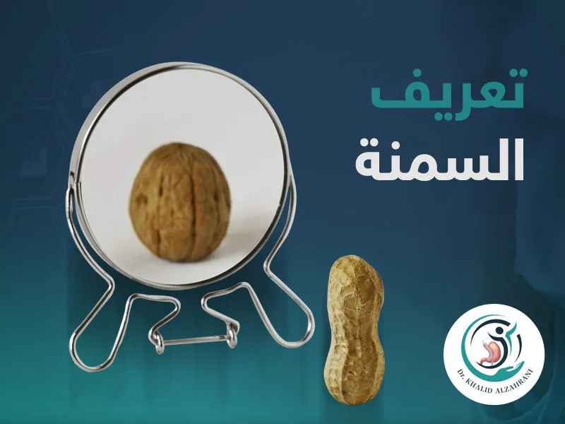 تعريف السمنة