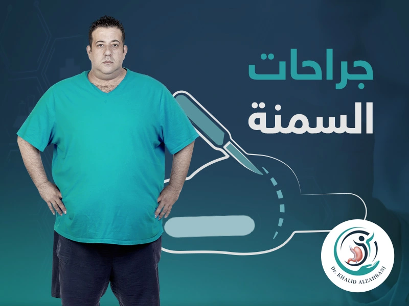 أنواع جراحات السمنة