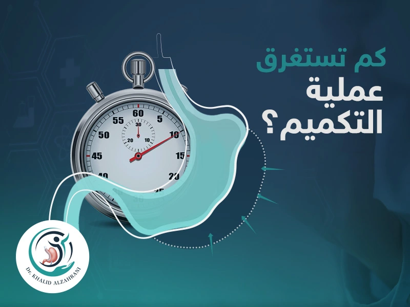 كم تستغرق عملية التكميم