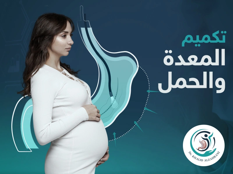 هل يزيد الوزن في الحمل بعد التكميم