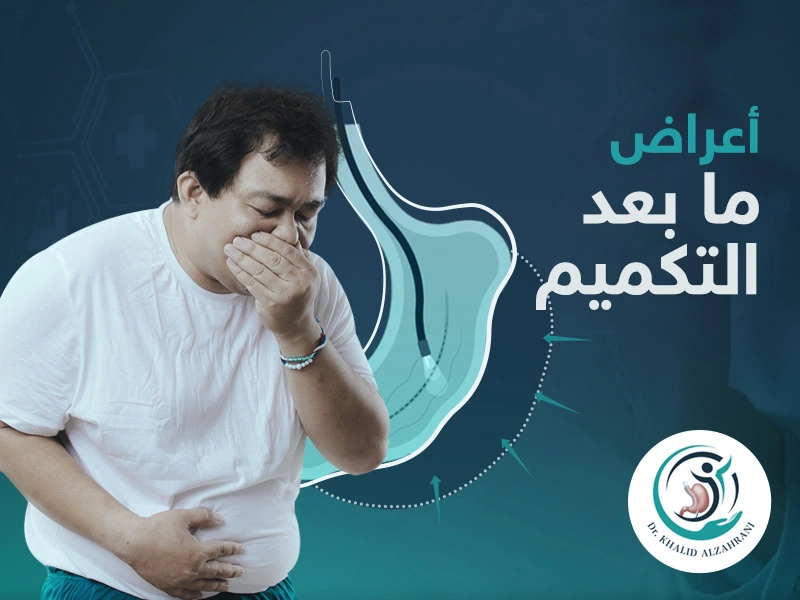 اعراض ما بعد التكميم