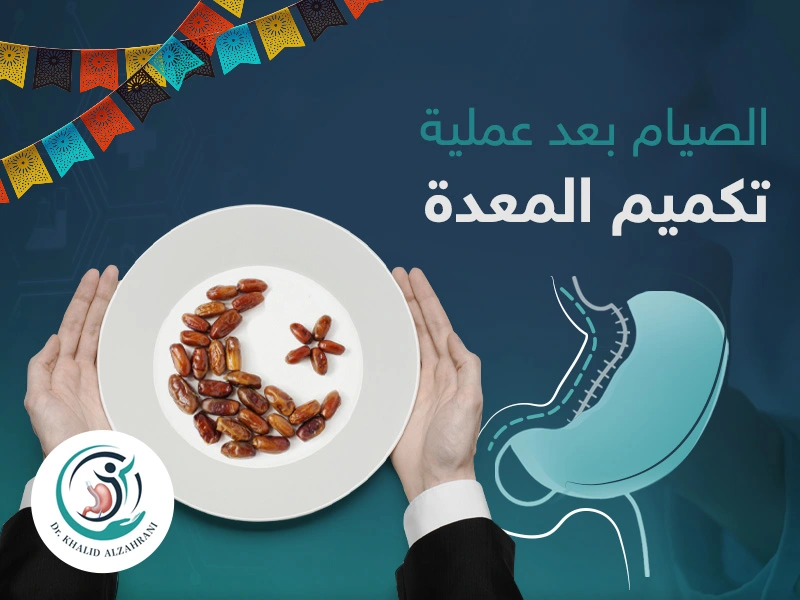 الصيام-بعد-عملية-التكميم الصيام بعد عملية التكميم
