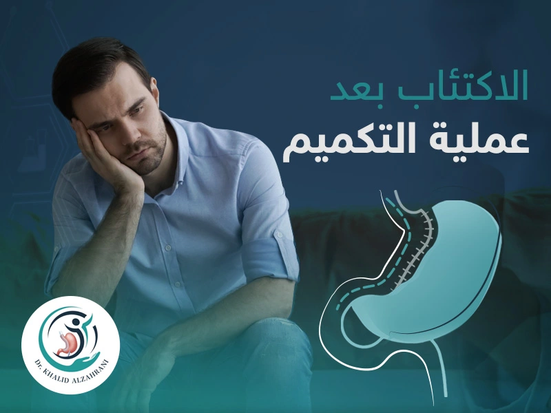 الاكتئاب بعد التكميم