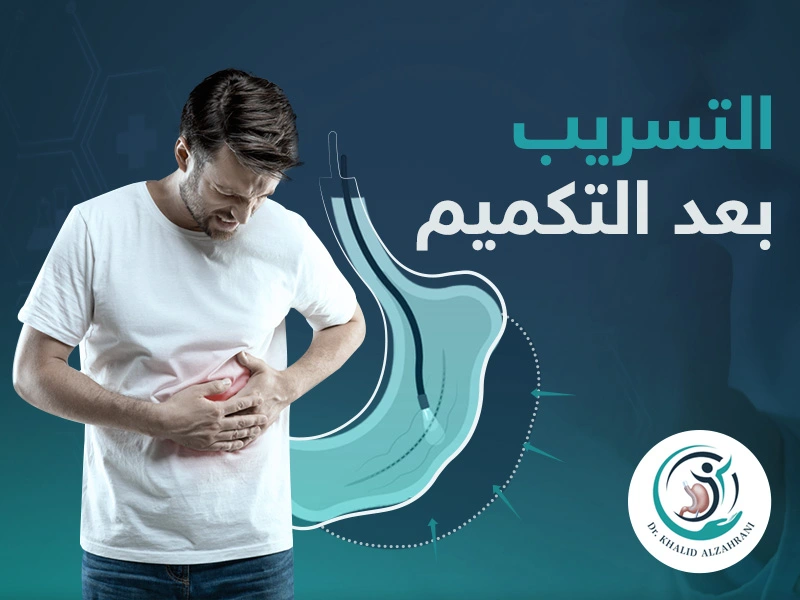 التسريب بعد التكميم