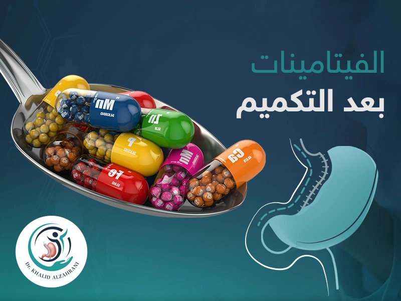 الفيتامينات بعد التكميم
