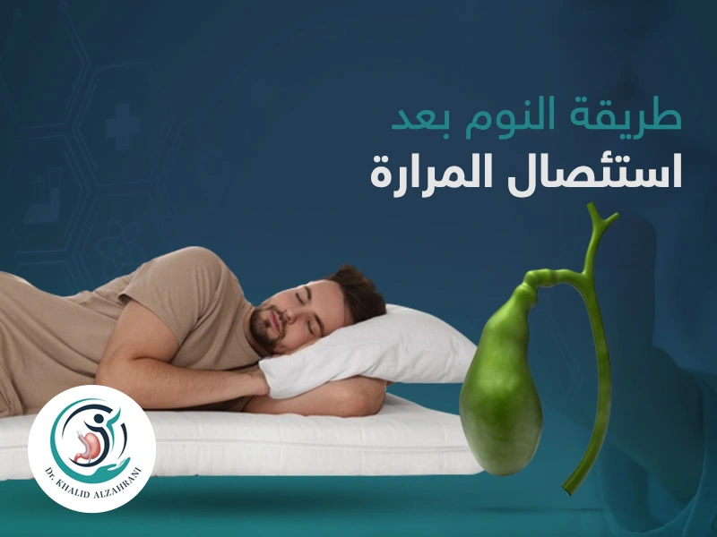 طريقة النوم بعد استئصال المرارة