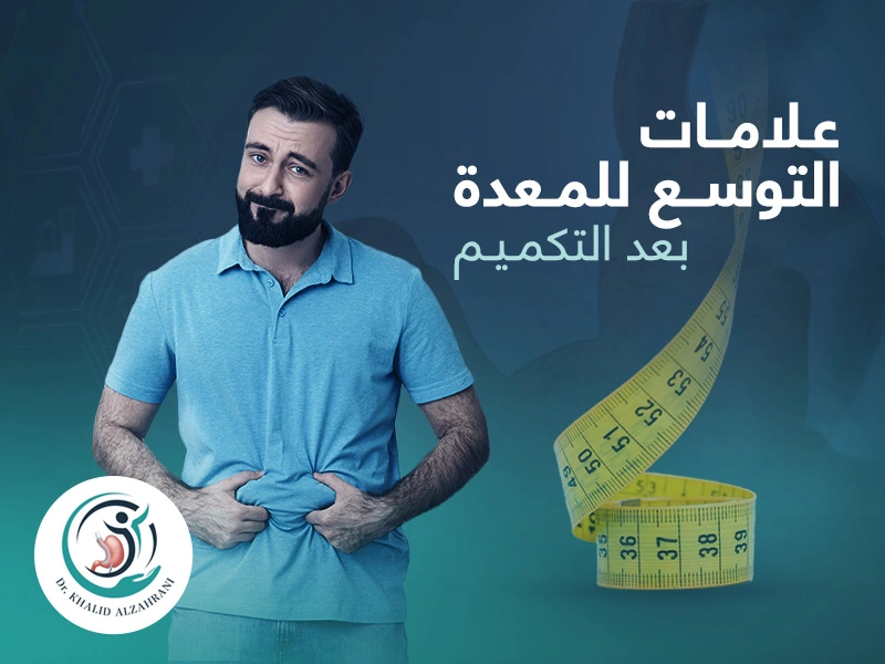 علامات توسع المعدة بعد التكميم