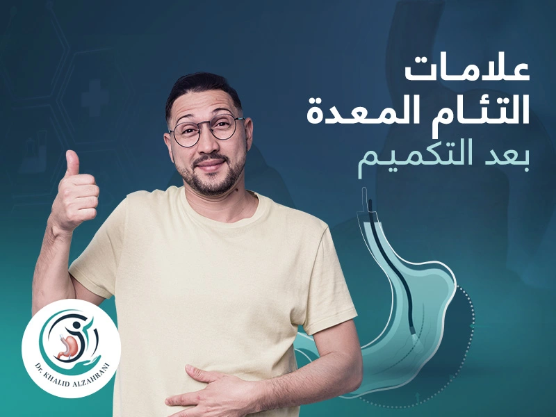 علامات التئام المعدة بعد التكميم