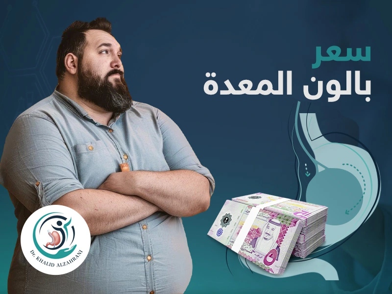 سعر بالون المعدة