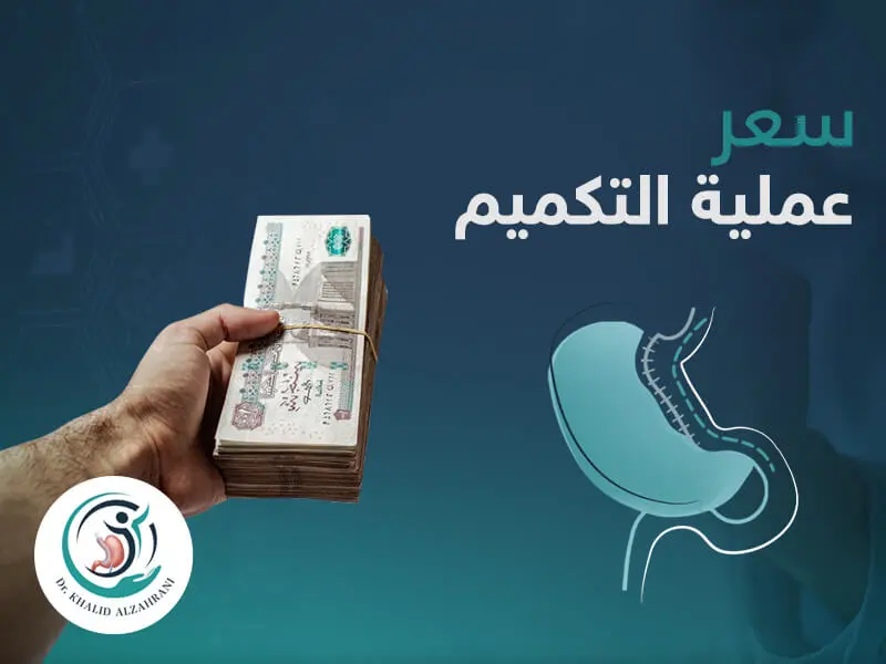 سعر عملية التكميم