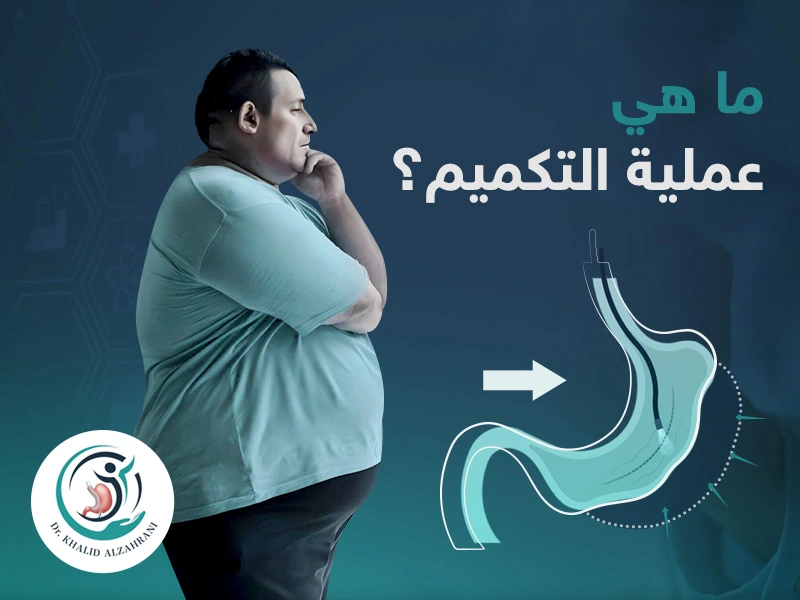 ما هي عملية التكميم