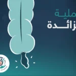 عملية الزائدة